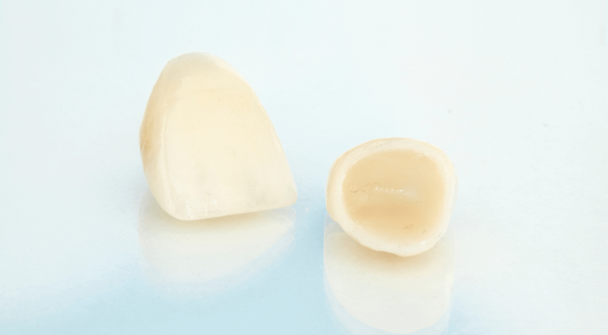 Do you need crowns or fillings?
