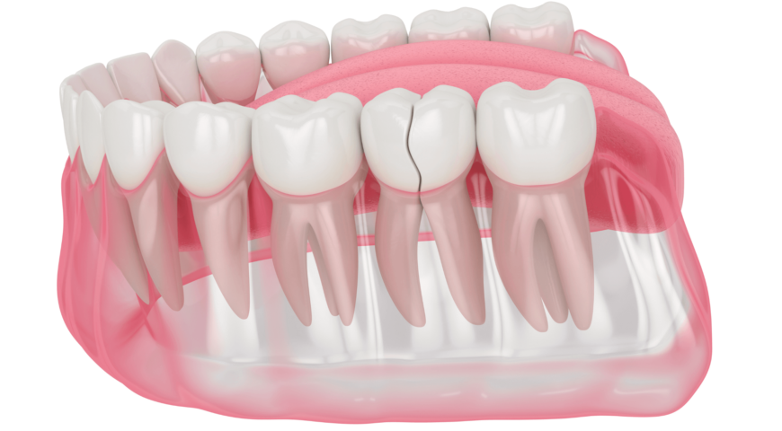 Does smoking affect your teeth?