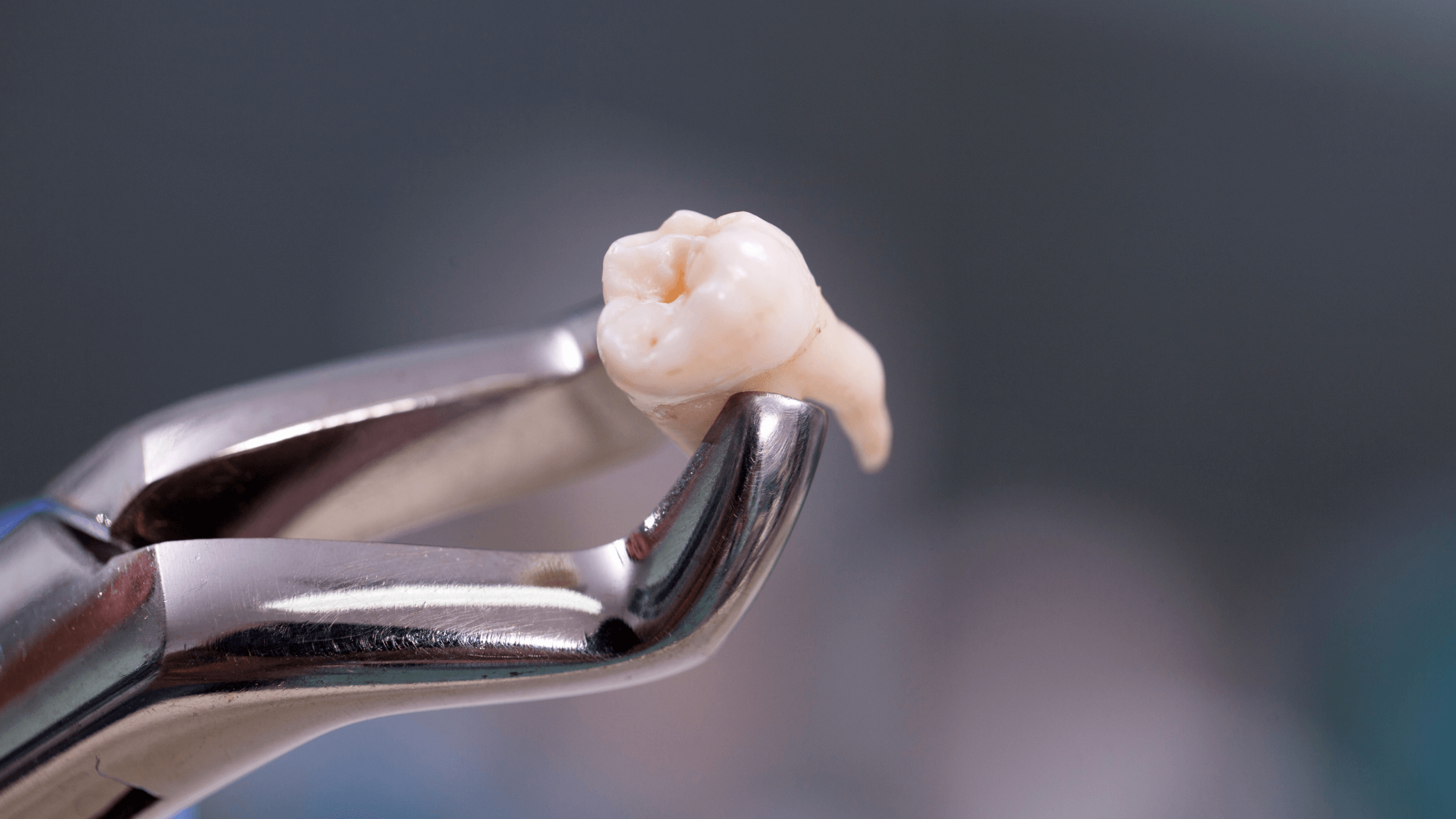 How Can I Make My Tooth Extraction Heal Faster?
