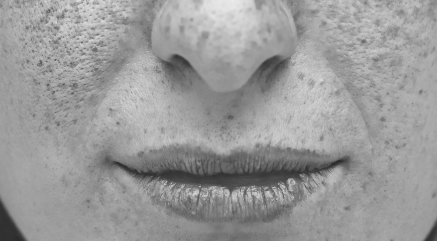 Everything You Need To Know About Lip Cancer