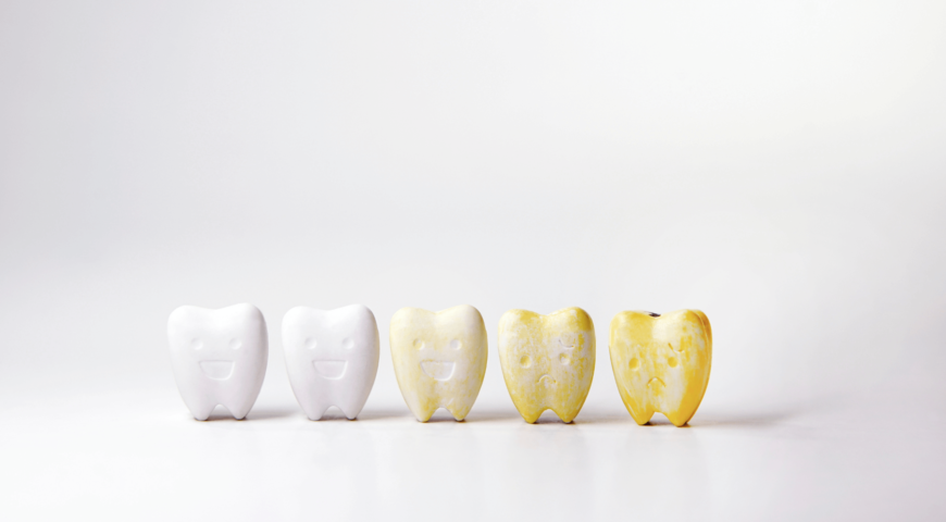 What Foods Stain Your Teeth?