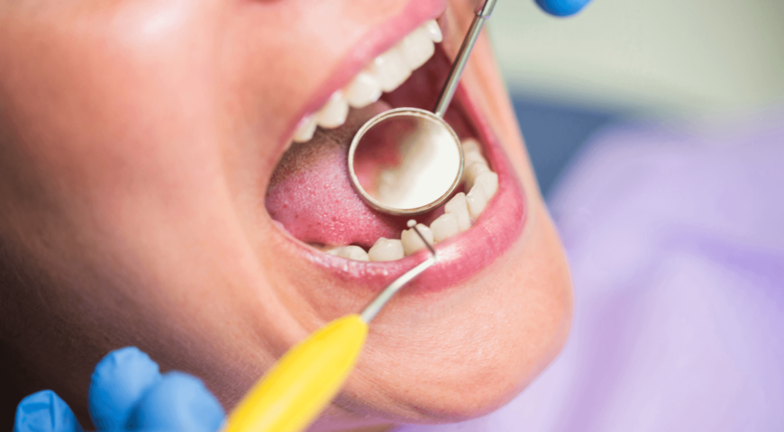 The Impact of Oral Bacteria on Heart Health: What You Need to Know