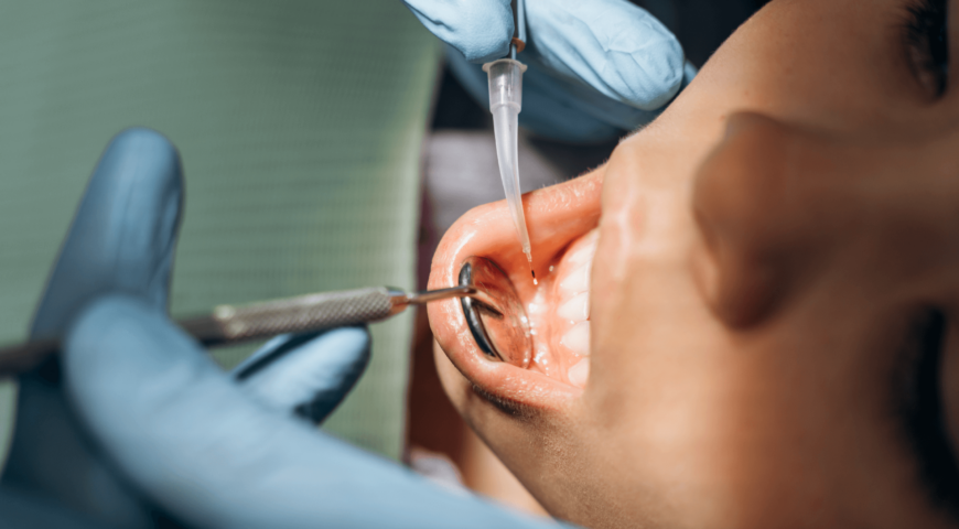 How Gum Boils Affect Your Oral Health