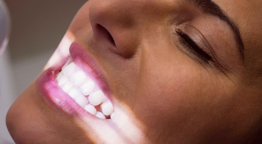 Can Whitening Damage Enamel?