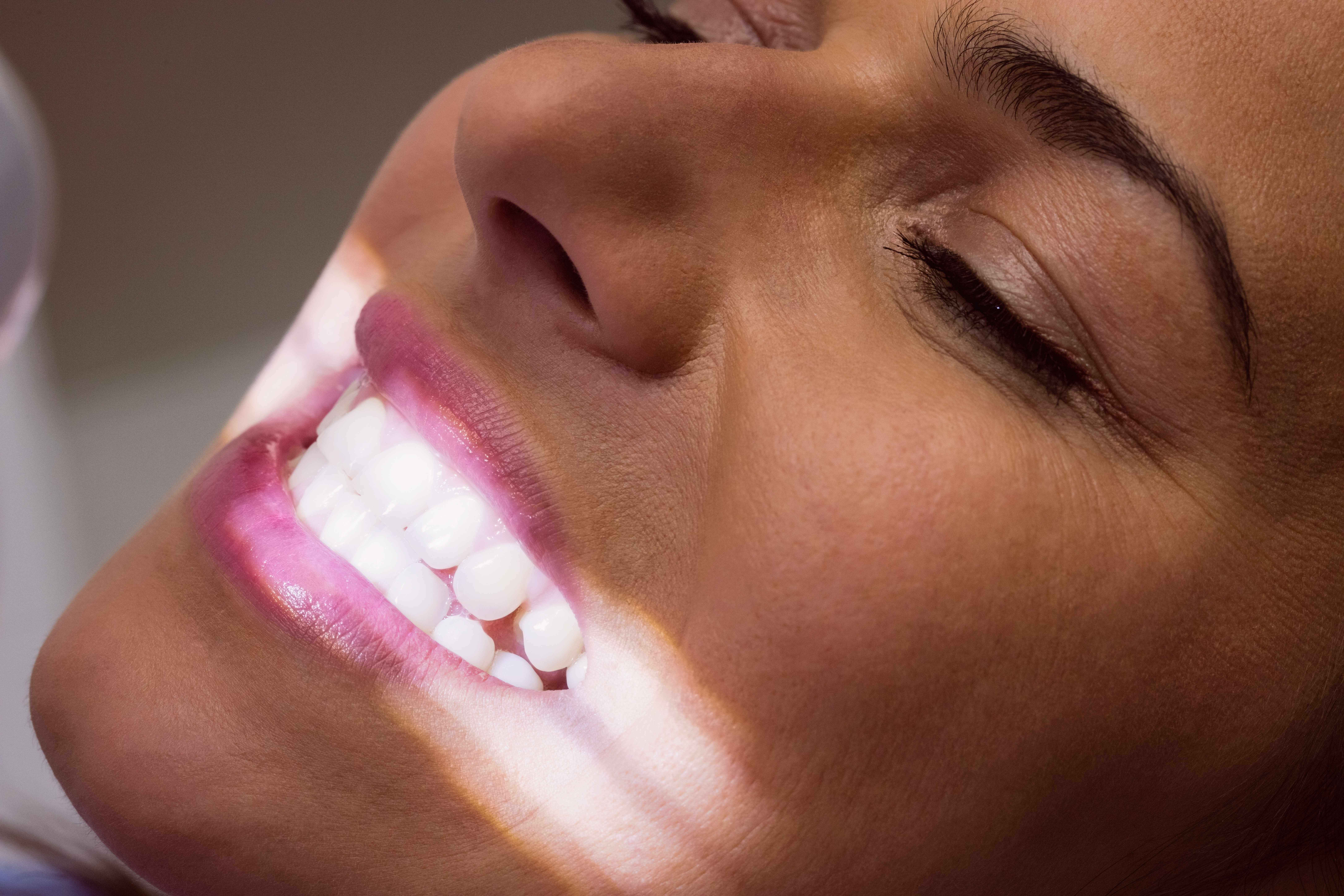 Can Whitening Damage Enamel?