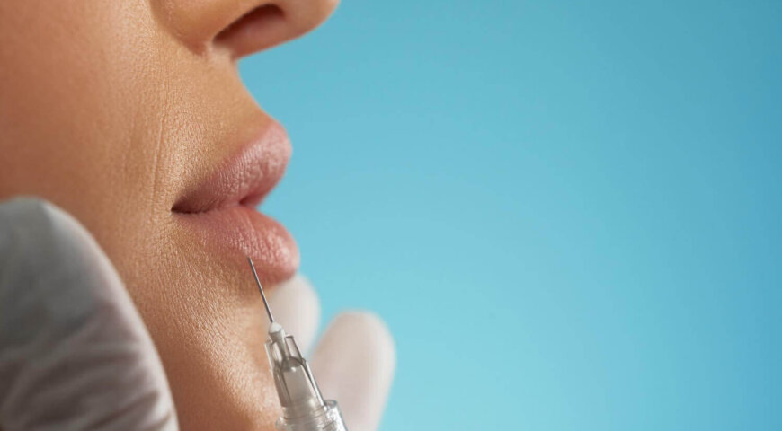 The Dental Impact Of Lip Fillers