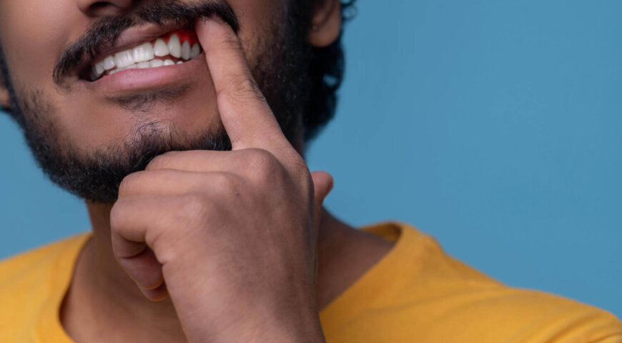 Gum Disease In Men: Signs, Causes And Why It’s More Common